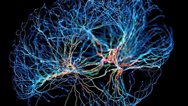 Image of brain