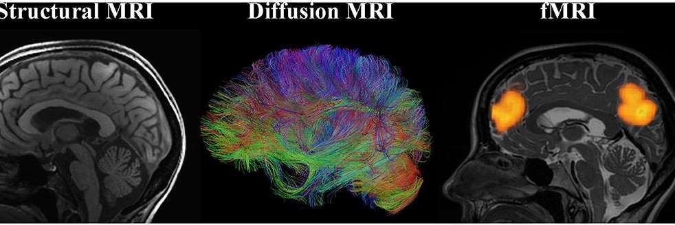 Image of brains